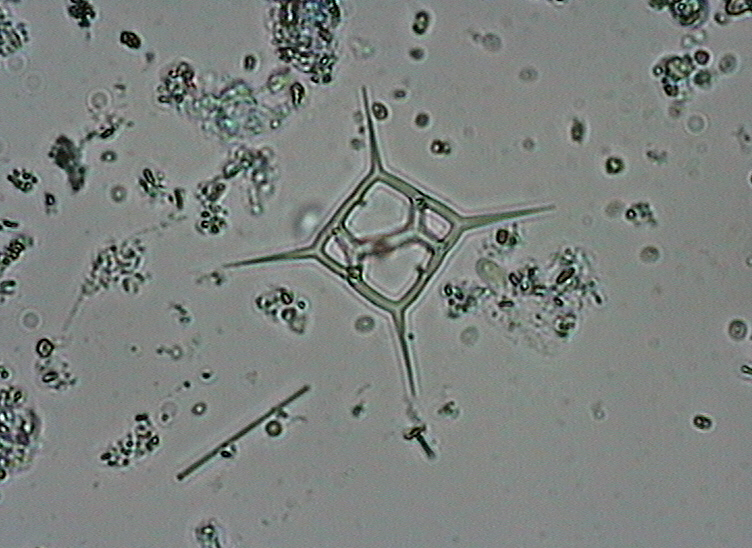 The alga&nbsp;Dictyocha fibula&nbsp;is equipped with a long, wing-shaped flagellum