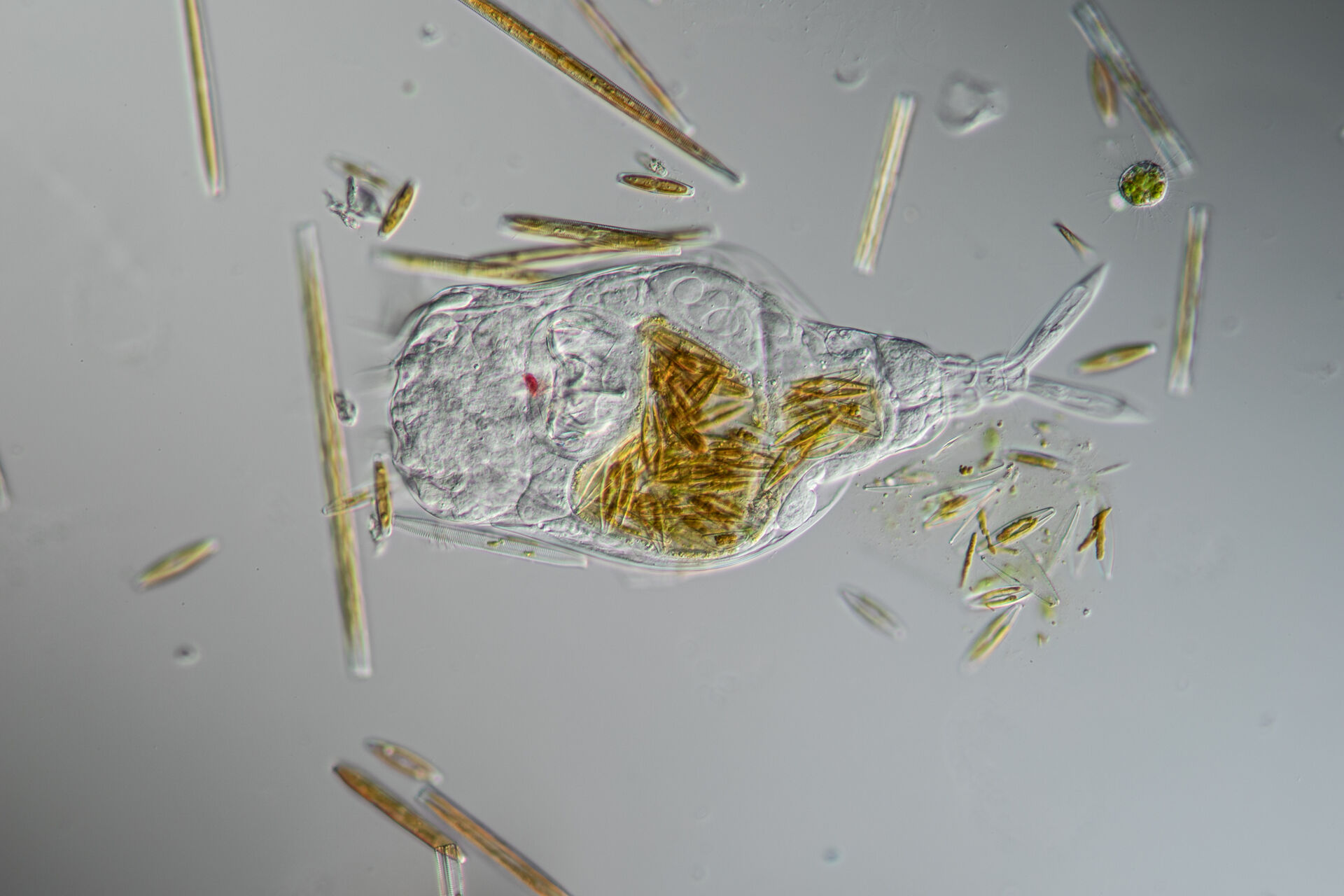 A rotifer (Rotifera)