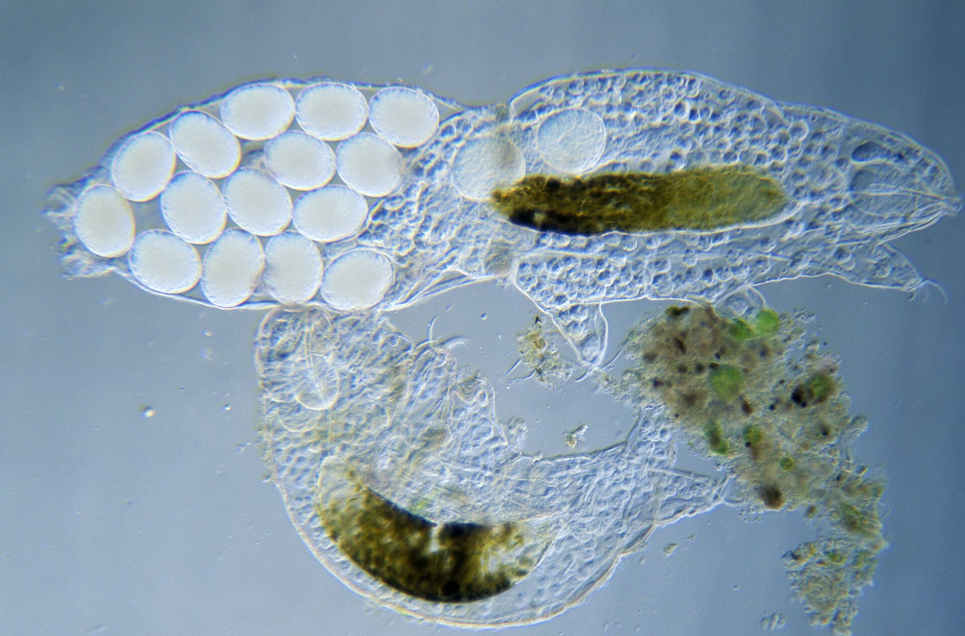 A tardigrade (Tardigrada)